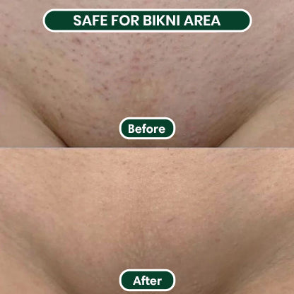 2 in 1 Woman Body Shaver Bikini Shaver